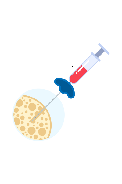 Biopsja fuzyjna gruczołu krokowego